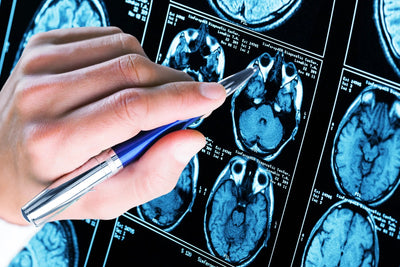 Hand holding a pen pointing at blue MRI brain scan images on a lightbox